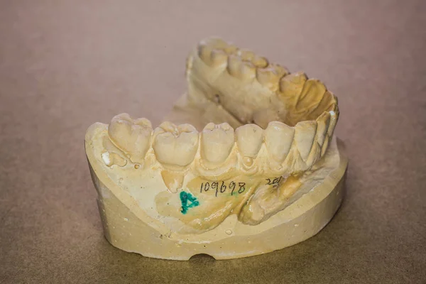 Upper jaw impression as a plaster model