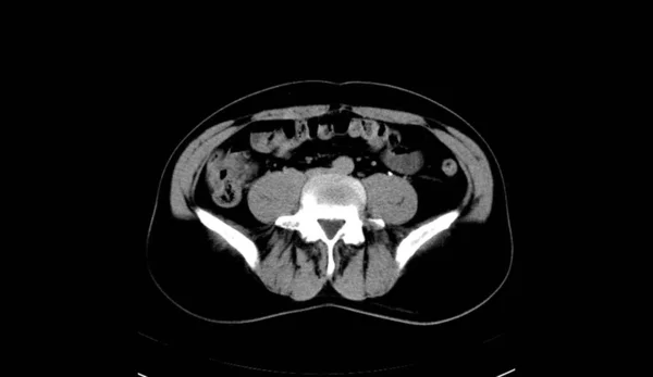 Абдомен Людина Людина Сканування — стокове фото