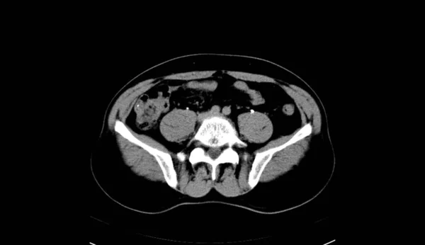 Abdomen Human Man Scan — 图库照片