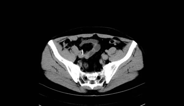 Abdomen Human Man Scan — 图库照片