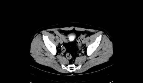 Abdomen Human Man Scan — 图库照片