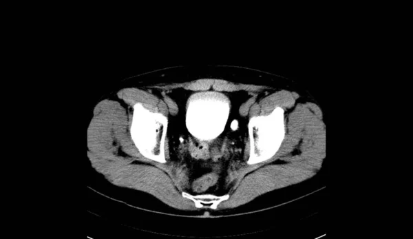 Abdomen Human Man Scan — 图库照片