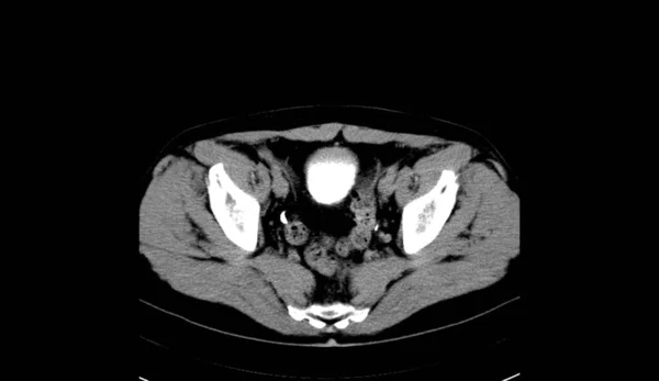 Abdomen Human Man Scan — 图库照片