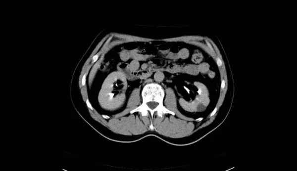 Abdomen Human Man Scan — 图库照片