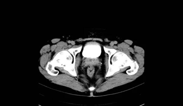 Abdomen Human Man Scan — 图库照片