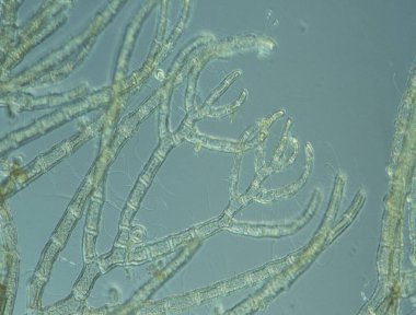 Deniz suyu kırmızı yosunları dalgalanıyor.