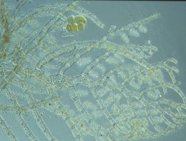 Deniz suyu kırmızı yosunları dalgalanıyor.