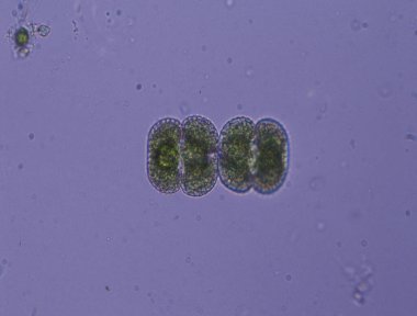 Mikroskop altında bölümde dekoratif algler 100x