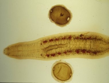 Sülükler gölette yüzer