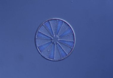 Mikroskop altında denizden gelen diatomlar 100x