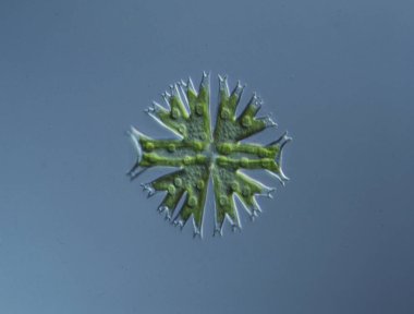 Süslü algler Micrasterias 'ın su damlaları 100 x