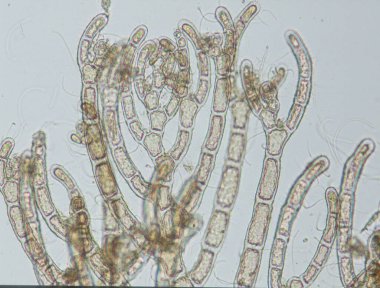 Deniz suyu kırmızı yosunları dalgalanıyor.