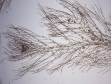 Mikroskop altında kırmızı algler 100 x