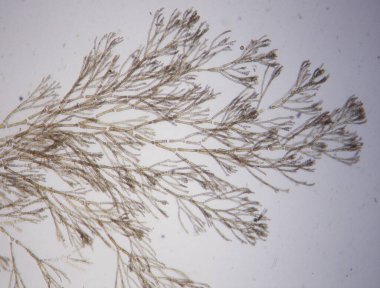 Rotalgen unter dem Mikroskop 100x