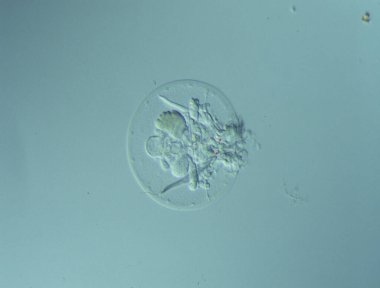 Bir damla suda mikroskop altında dönen hayvanlar... 100 kat fazla.