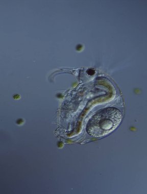 Bir damla suda mikroskop altında dönen hayvanlar... 100 kat fazla.