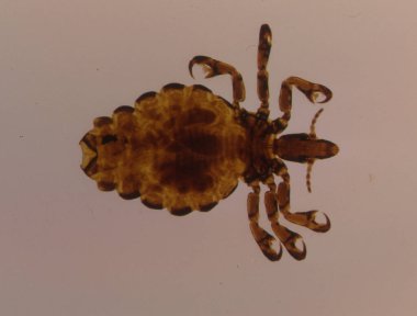 Mikroskop altında parazit olarak domuz pisliği 50x