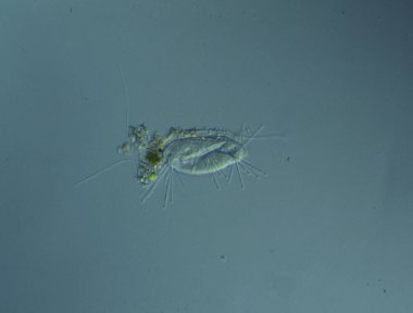 Mikroskop altında 100 kat su damlatarak işliyor.