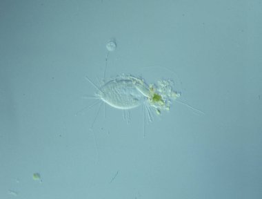 Mikroskop altında 100 kat su damlatarak işliyor.