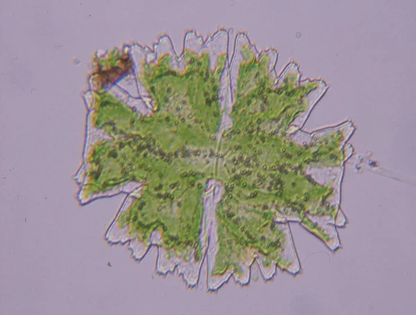 100倍の水の滴の観賞用藻類ミクロステリア — ストック写真