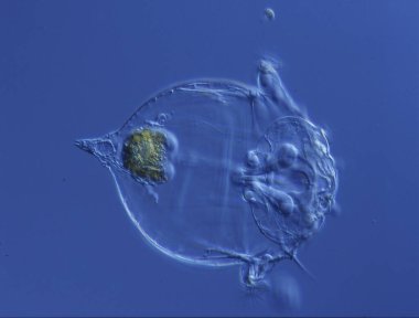 Bir damla suda mikroskop altında dönen hayvanlar... 100 kat fazla.