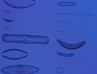 Mikroskop altında denizden gelen diatomlar 100x