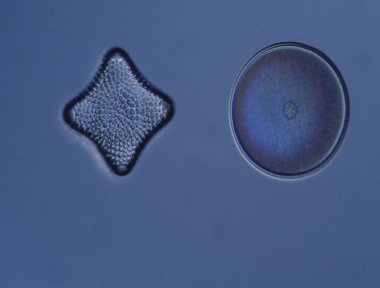 Mikroskop altında denizden gelen diatomlar 100x