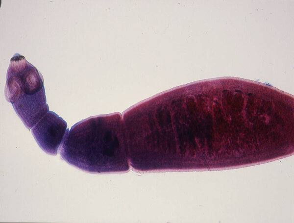 Tapeworm with segments and suction cups in high magnification