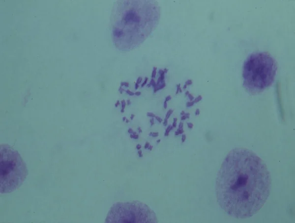 Chromosomy Jądrze Komórki — Zdjęcie stockowe