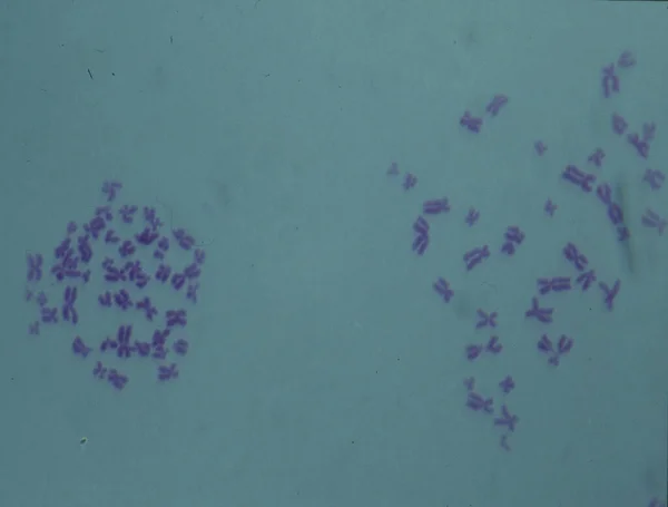 Chromosomes Dans Noyau Une Cellule — Photo