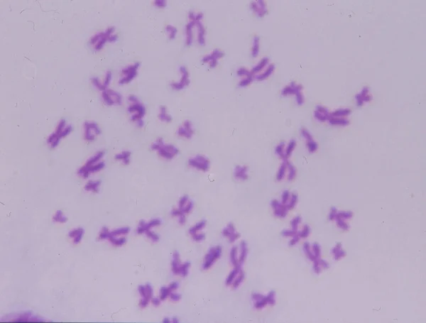 Chromosomen Von Mir Unter Dem Mikroskop — Stockfoto