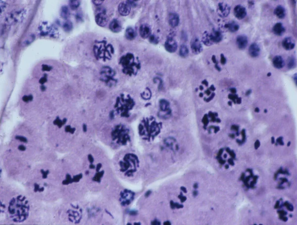 Cromosomi Nel Nucleo Una Cellula — Foto Stock