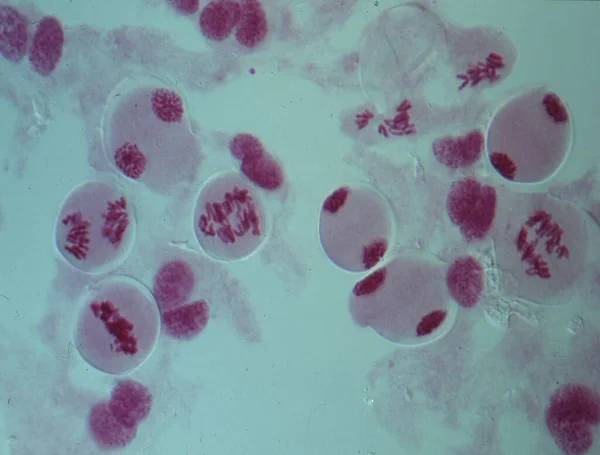 Хромосомы Ядре Клетки — стоковое фото