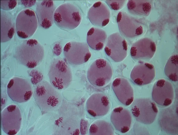 Bir Hücrenin Çekirdeğindeki Kromozomlar — Stok fotoğraf