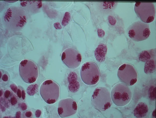 Chromosomy Jądrze Komórki — Zdjęcie stockowe