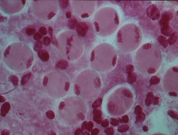 Chromosomy Jądrze Komórki — Zdjęcie stockowe