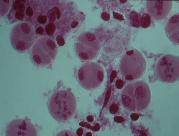 Хромосоми Ядрі Клітини — стокове фото