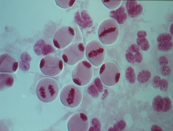 Cromosomas Núcleo Una Célula —  Fotos de Stock
