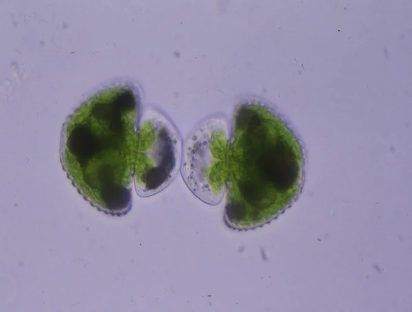 100X显微镜下分割的装饰藻类 — 图库照片