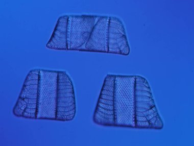 Mikroskop altında denizden gelen diatomlar 100x