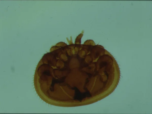 显微镜下的Varroa蜜蜂螨 — 图库照片