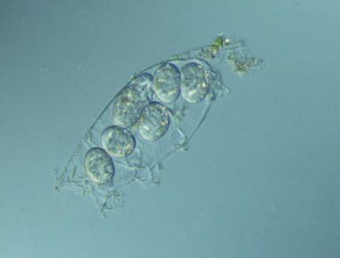 Kış için yumurtalı tardigrad deri.