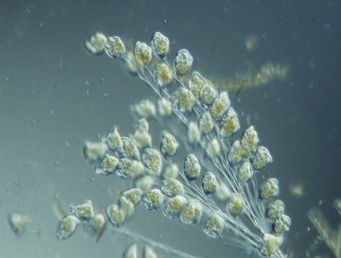 Mikroskop altında su damlalarında silikat ve amipler.