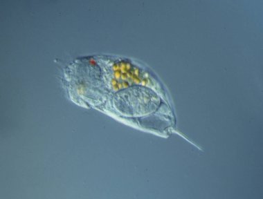 Rotiferler mikroskop altında suda yüzerler.