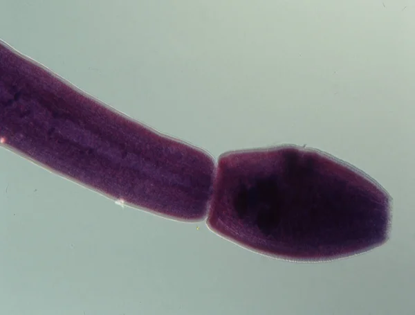 Tapeworm Con Extremidades Bajo Microscopio — Foto de Stock