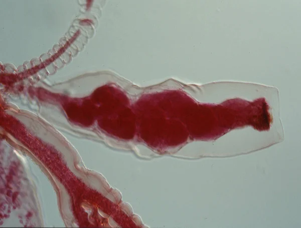 Czerwony Polip Kij Pod Mikroskopem — Zdjęcie stockowe