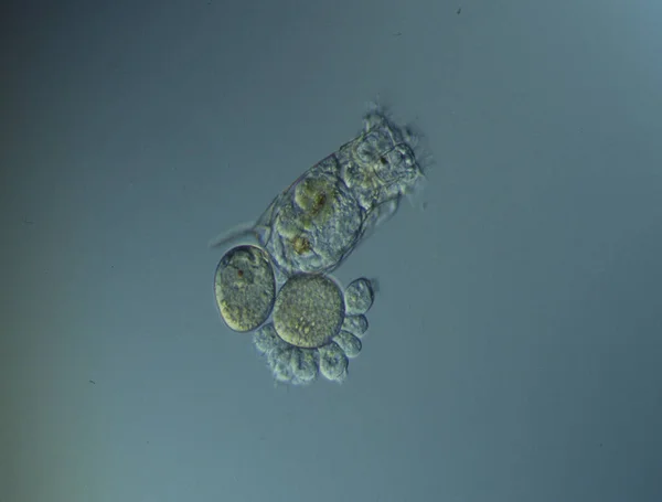 Les Rotifères Nagent Dans Eau Sous Microscope — Photo
