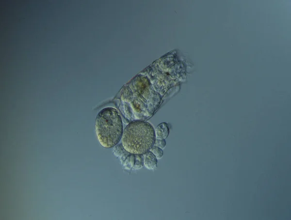 Les Rotifères Nagent Dans Eau Sous Microscope — Photo