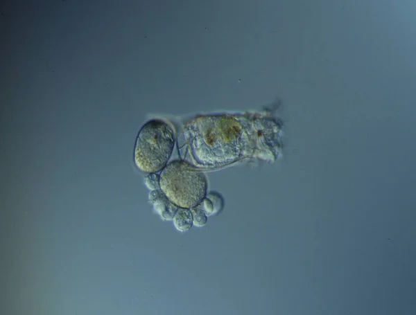 Les Rotifères Nagent Dans Eau Sous Microscope — Photo