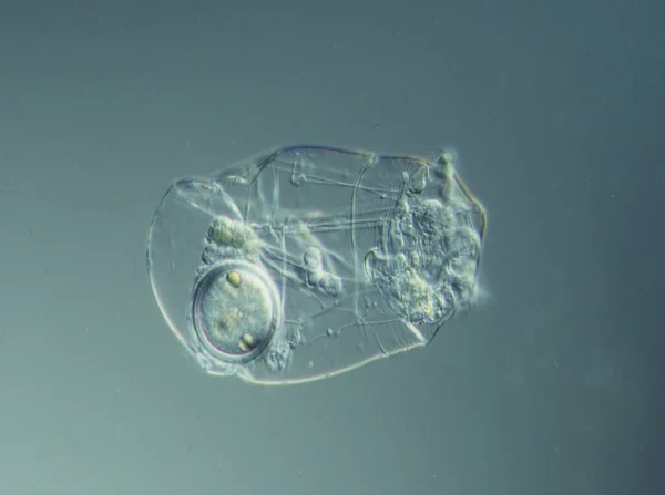 Les Rotifères Nagent Dans Eau Sous Microscope — Photo